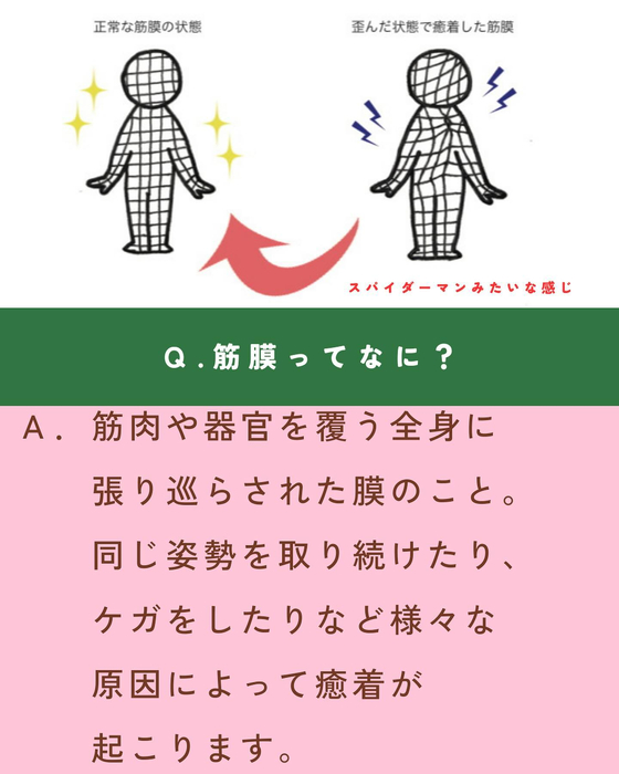 画像1474